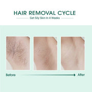 BeNat Health & Beauty As shown / One Size Laser IPL Hair Remover